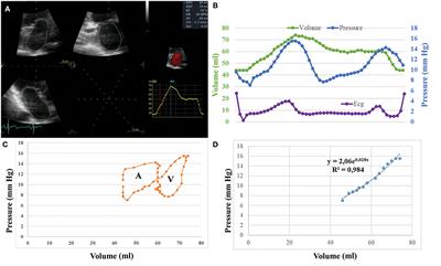 Left Atrial Function Post Radiofrequency and Cryoballoon Ablation Assessed by Volume-Pressure Loops